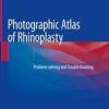 Photographic Atlas of Rhinoplasty book and videos