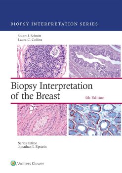Biopsy Interpretation of the Breast (Biopsy Interpretation Series), 4th Edition (EPUB and pdf)