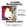 Closed Atraumatic Rhinoplasty Live Surgery DVD 7 2 Cases Rhinoplasty FaceLift NeckLift Digital