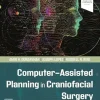 Computer-Assisted Planning In Craniofacial Surgery (EPub+Converted PDF+Videos)