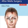 Facial Reconstruction After Mohs Surgery EPUB