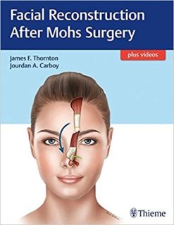 Facial Reconstruction After Mohs Surgery EPUB
