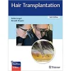 Hair Transplantation, 6th edition (Original PDF from Publisher)