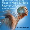 Local And Regional Flaps In Head And Neck Reconstruction A Practical Approach VideosPPT