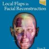 Local Flaps In Facial Reconstruction 4th Edition True PDF 1