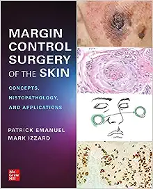 Margin Control Surgery Of The Skin Concepts Histopathology And Applications Original PDF From Publisher