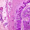 Oakstone Dermatopathology 2025