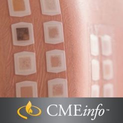 The Brigham Board Review in Allergy Immunology Brigham and Womens Hospital Board Review