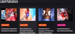 surgical Video Articles JOMI Video Journal Peer Reviewed