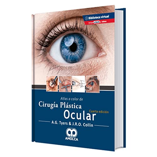 Atlas a color de cirugía plástica ocular, 4a Edición (Scanned PDF)
