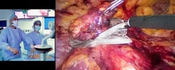 surgical Video Articles JOMI Video Journal Peer Reviewed 2023