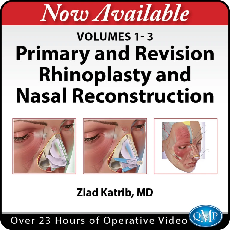 QMP Primary and Revision Rhinoplasty and Nasal Reconstruction, Volumes 1-3 2026