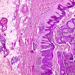 Oakstone Dermatopathology 2025