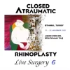 Closed Atraumatic Rhinoplasty Live Surgery DVD 6