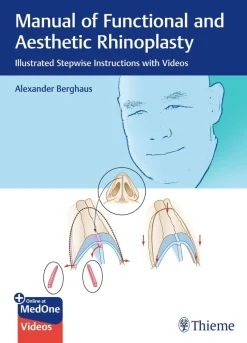 Manual of Functional and Aesthetic Rhinoplasty Illustrated Stepwise Instructions with Videos (Original PDF from Publisher+Videos)