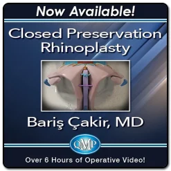 Closed Preservation Rhinoplasty 2023