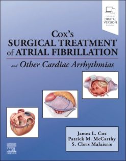 Cox’s Surgical Treatment of Atrial Fibrillation (EPUB)