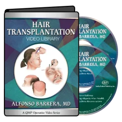QMP Hair Transplantation 2017