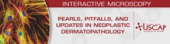 USCAP Pearls, Pitfalls, and Updates in Neoplastic Dermatopathology 2025