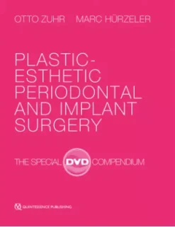 Plastic-Esthetic Periodontal and Implant Surgery The Special DVD Compendium