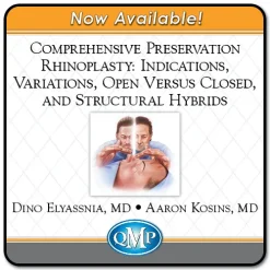 QMP Comprehensive Preservation Rhinoplasty Indications, Variations, Open Versus Closed, and Structural Hybrids 2022