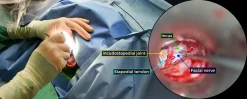 surgical Video Articles JOMI Video Journal Peer Reviewed3 2023