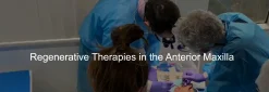 VISTA Institute for Therapeutic Innovations Regenerative Therapies in the Anterior Maxilla 2021